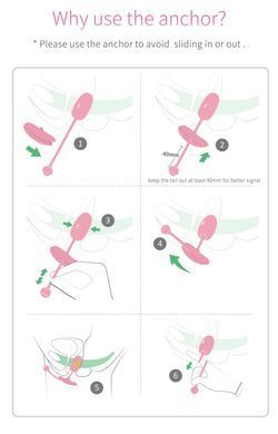 Смарт-тренажер Кегеля Magic Motion Kegel Coach - фото